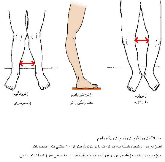 معافیت از سربازی